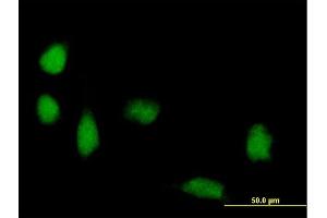 Immunofluorescence of purified MaxPab antibody to FOXP3 on HeLa cell. (FOXP3 抗体  (AA 1-431))