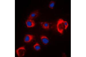 Immunofluorescent analysis of ZIP7 staining in MCF7 cells.