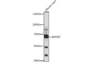 Western blot analysis of extracts of mouse heart, using ZNF587 antibody (ABIN7271507) at 1:1000 dilution. (ZNF587 抗体  (AA 120-240))