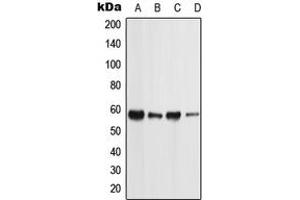 Western blot analysis of PIGW expression in MCF7 (A), NTERA2 (B), Raw264. (PIGW 抗体  (C-Term))