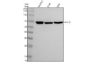 Western blot analysis of PTH1R using anti-PTH1R antibody (ABIN7605855).