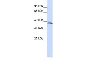 WB Suggested Anti-EDA Antibody Titration:  0. (Ectodysplasin A 抗体  (Middle Region))