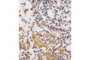 (ABIN652075 and ABIN2840539) staining CUX1 in human lymph node tissue sections by Immunohistochemistry (IHC-P - paraformaldehyde-fixed, paraffin-embedded sections). (CUX1 抗体  (AA 1347-1374))
