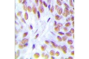 Immunohistochemistry (IHC) image for anti-Nuclear Receptor Subfamily 3, Group C, Member 1 (Glucocorticoid Receptor) (NR3C1) antibody (ABIN7303800)