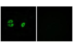 Immunofluorescence analysis of A549 cells, using MRPS22 antibody. (MRPS22 抗体  (Internal Region))