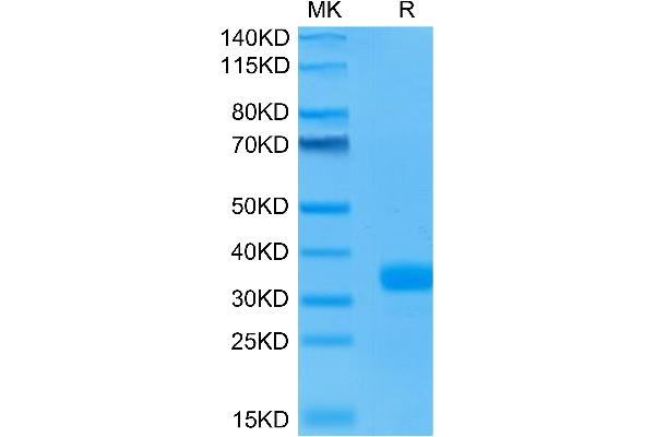 Angiopoietin 2 Protein (ANGPT2) (AA 275-496) (His-Avi Tag)