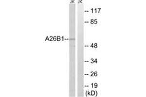 Western blot analysis of extracts from Jurkat cells, using A26B1 Antibody. (POTEB 抗体  (AA 481-530))