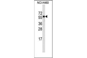 Image no. 1 for anti-Cytochrome P450, Family 4, Subfamily A, Polypeptide 11 (CYP4A11) (C-Term) antibody (ABIN360251) (CYP4A11 抗体  (C-Term))