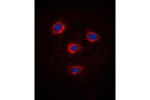 Immunofluorescent analysis of Frizzled 8 staining in Jurkat cells. (FZD8 抗体  (C-Term))