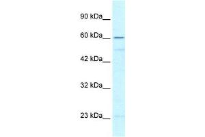 Human Jurkat; WB Suggested Anti-ZNF212 Antibody Titration: 0. (ZNF212 抗体  (N-Term))