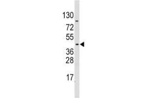 Western blot analysis of PDK4 antibody and CEM lysate (PDK4 抗体  (AA 250-277))