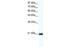 WB Suggested Anti-RAXL1 Antibody Titration:  1. (RAX2 抗体  (N-Term))