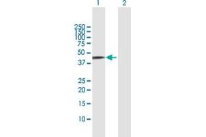 Western Blot analysis of FBXO4 expression in transfected 293T cell line by FBXO4 MaxPab polyclonal antibody. (FBXO4 抗体  (AA 1-387))