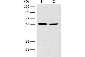 Western blot analysis of Mouse brain tissue NIH/3T3 cell lysates using CORO2B Polyclonal Antibody at dilution of 1:1000 (CORO2B 抗体)
