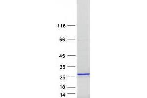 Western Blotting (WB) image for Fast Skeletal Troponin I (TNNI2) (Transcript Variant 1) protein (Myc-DYKDDDDK Tag) (ABIN2720884)