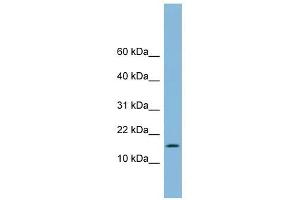 UBE2L6 antibody used at 1 ug/ml to detect target protein.