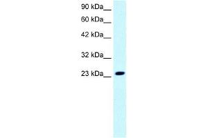Human Jurkat; WB Suggested Anti-FLJ11730 Antibody Titration: 0. (MEAF6 抗体  (N-Term))