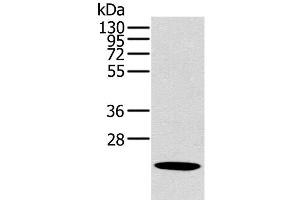 Western Blot analysis of Human liver cancer tissue using OTUB2 Polyclonal Antibody at dilution of 1:800 (OTUB2 抗体)