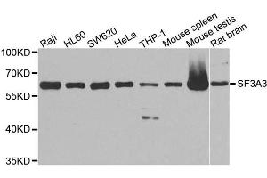 Western Blotting (WB) image for anti-Splicing Factor 3a, Subunit 3, 60kDa (SF3A3) antibody (ABIN1874748) (SF3A3 抗体)