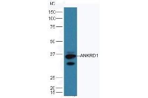 Mouse heart lysates probed with Rabbit Anti-ANKRD1 Polyclonal Antibod, Unconjugated  at 1:5000 90min in 37˚C. (ANKRD1 抗体  (AA 185-319))