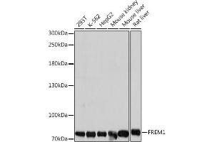 Western blot analysis of extracts of various cell lines, using FREM1 antibody (ABIN7267259) at 1:1000 dilution. (FREM1 抗体  (AA 1880-2179))