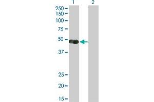 Western Blot analysis of NKX2-5 expression in transfected 293T cell line by NKX2-5 monoclonal antibody (M03), clone 3A7. (NK2 Homeobox 5 抗体  (AA 1-130))