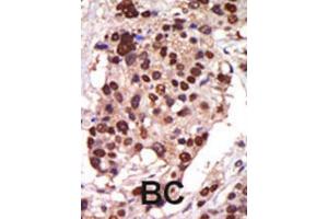 Immunohistochemistry (IHC) image for anti-Protein Kinase D3 (PRKD3) antibody (ABIN3002937)