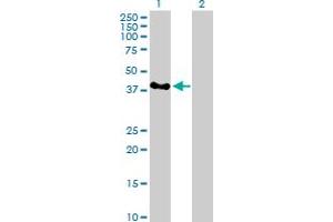 Western Blot analysis of SERTAD2 expression in transfected 293T cell line by SERTAD2 MaxPab polyclonal antibody. (SERTAD2 抗体  (AA 1-314))