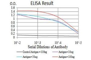 Black line: Control Antigen (100 ng),Purple line: Antigen (10 ng), Blue line: Antigen (50 ng), Red line:Antigen (100 ng) (TBCC 抗体  (AA 1-196))