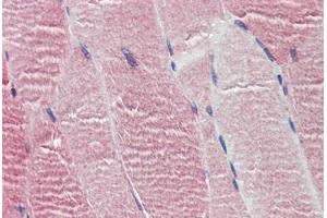 Human Skeletal Muscle: Formalin-Fixed, Paraffin-Embedded (FFPE) (HTR2C 抗体  (AA 387-446))