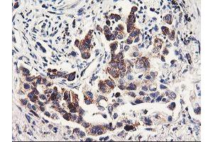 Image no. 6 for anti-Prenyl (Decaprenyl) Diphosphate Synthase, Subunit 2 (PDSS2) antibody (ABIN1500138)