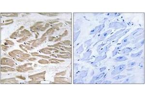 Immunohistochemistry analysis of paraffin-embedded human heart tissue, using BRP44L Antibody. (BRP44L 抗体  (AA 11-60))
