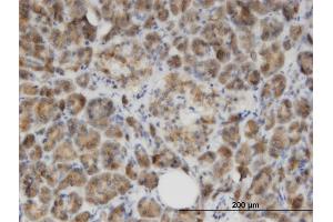 Immunoperoxidase of monoclonal antibody to GLYAT on formalin-fixed paraffin-embedded human salivary gland. (GLYAT 抗体  (AA 64-163))