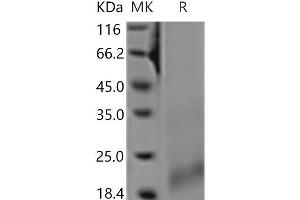 Western Blotting (WB) image for Tumor Necrosis Factor Receptor Superfamily, Member 13C (TNFRSF13C) protein (His tag) (ABIN7321204) (TNFRSF13C Protein (His tag))