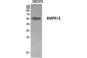 Western Blot (WB) analysis of SKOV3 cells using CD292 Polyclonal Antibody. (BMPR1A 抗体  (Internal Region))