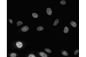 Immunofluorescent staining of A549 (ATCC CCL-185) cells. (MDM2 抗体  (AA 154-167))