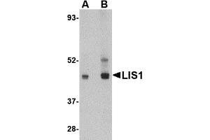 Western Blotting (WB) image for anti-Platelet-Activating Factor Acetylhydrolase 1b, Regulatory Subunit 1 (45kDa) (PAFAH1B1) (C-Term) antibody (ABIN1030486) (PAFAH1B1 抗体  (C-Term))