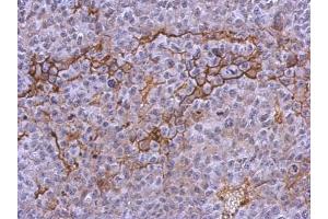 IHC-P Image Immunohistochemical analysis of paraffin-embedded PC13 xenograft, using CD41, antibody at 1:500 dilution. (Integrin Alpha2b 抗体  (Internal Region))