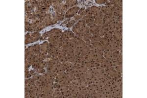 Immunohistochemical staining of human pancreas with UBXN6 polyclonal antibody  shows strong nuclear and cytoplasmic positivity in exocrine glandular cells at 1:20-1:50 dilution.