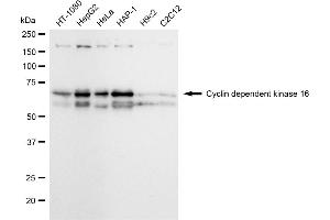 Western blotting analysis using Cyclin dependent kinase 16 antibody (ABIN7798208). (Recombinant CDK16 抗体)
