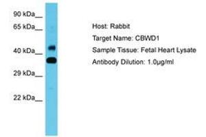 Image no. 1 for anti-COBW Domain Containing 1 (CBWD1) (AA 108-157) antibody (ABIN6750642) (CBWD1 抗体  (AA 108-157))