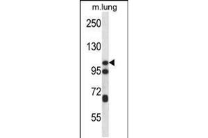 Western blot analysis in mouse lung tissue lysates (35ug/lane). (CTNND2 抗体  (C-Term))