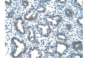 GNAS antibody was used for immunohistochemistry at a concentration of 4-8 ug/ml to stain Alveolar cells (arrows) in Human Lung. (GNAS 抗体  (N-Term))