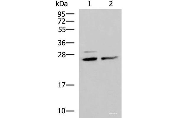 SNRPB2 anticorps