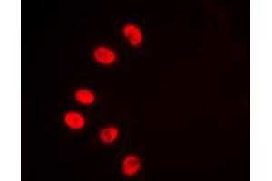 Immunofluorescent analysis of NR2F2 staining in HeLa cells. (NR2F2 抗体  (N-Term))