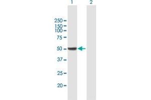Western Blot analysis of ALDH9A1 expression in transfected 293T cell line by ALDH9A1 MaxPab polyclonal antibody. (ALDH9A1 抗体  (AA 1-494))