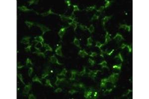 Immunofluorescence analysis of CA9 antibody with HeLa cells. (CA9 抗体  (AA 113-143))