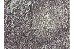 Image no. 2 for anti-Malignant T Cell Amplified Sequence 1 (MCTS1) (AA 1-181) antibody (ABIN1490598) (MCTS1 抗体  (AA 1-181))