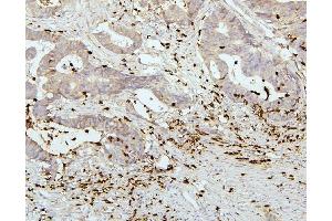 IHC analysis of PEF1 using anti-PEF1 antibody (ABIN6719632). (PEF1 抗体  (AA 170-284))