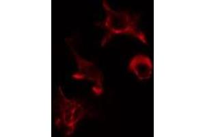 ABIN6275563 staining HuvEc cells by IF/ICC. (SH2B2 抗体  (N-Term))
